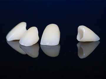 Who Can Benefit from a Same-Day Dental Crowns Procedure?